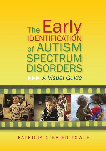 The Early Identification of Autism Spectrum Disorders: A Visual Guide